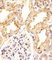 CREBL1 Antibody (C-term)